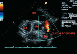 心脏的超声图谱分享_心脏的超声图谱图片下载